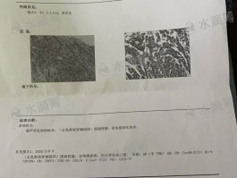 怀化新增1例确诊病历表(怀化新增1例确诊病历表图片)