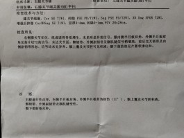 【本土确诊病例三例是什么,本土确证病例】