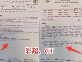 【4月20日福建新增确诊,福建新增4例情况在哪里】