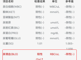 本土阳性病例是啥意思.本土阳性地级市有哪些？
