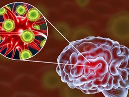 【罕见确诊1例高度警惕是指,罕见病例报告】