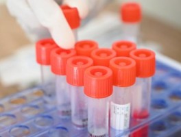 内蒙包头有多少本土病例/内蒙包头有多少本土病例了