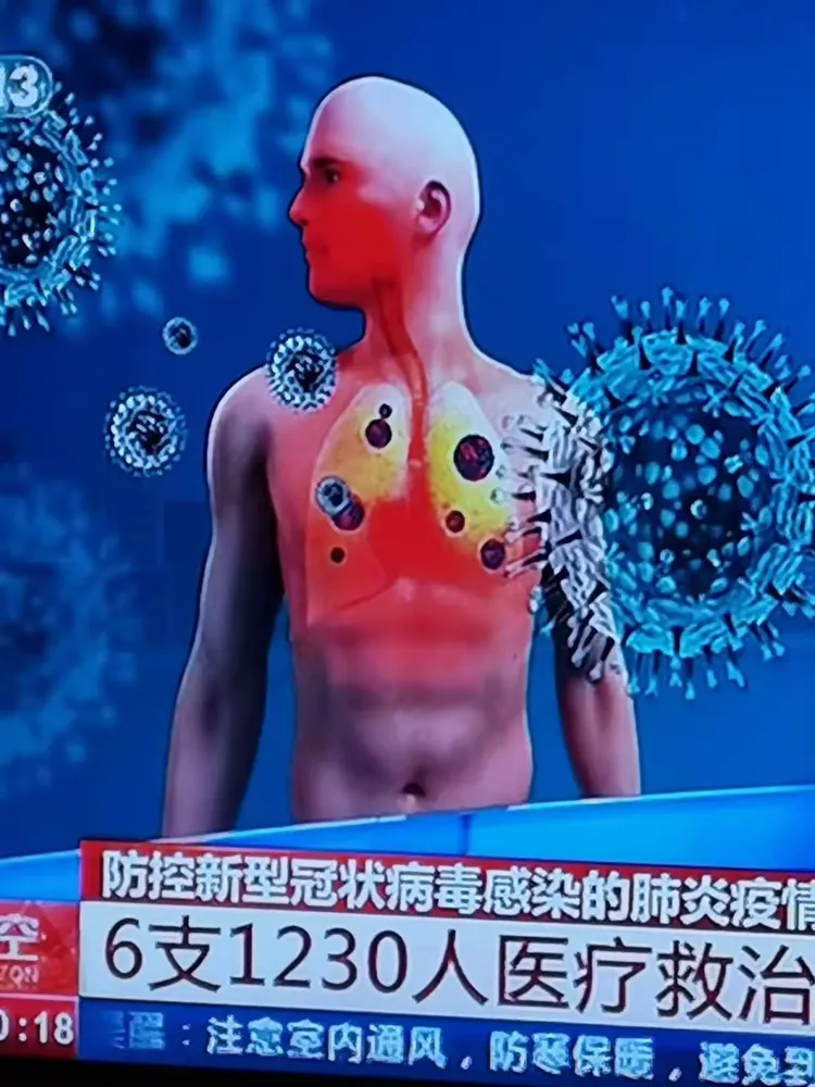 中国疫情的多发地区是/我国疫情爆发的几个地方-第3张图片